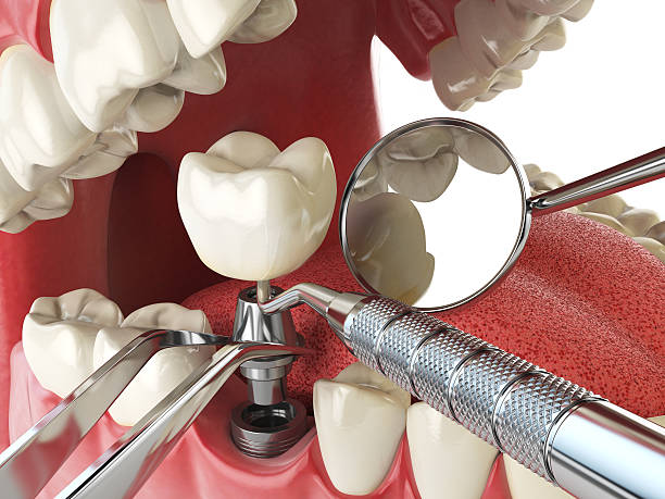 Best 24-Hour Emergency Dental Care in Hewitt, TX